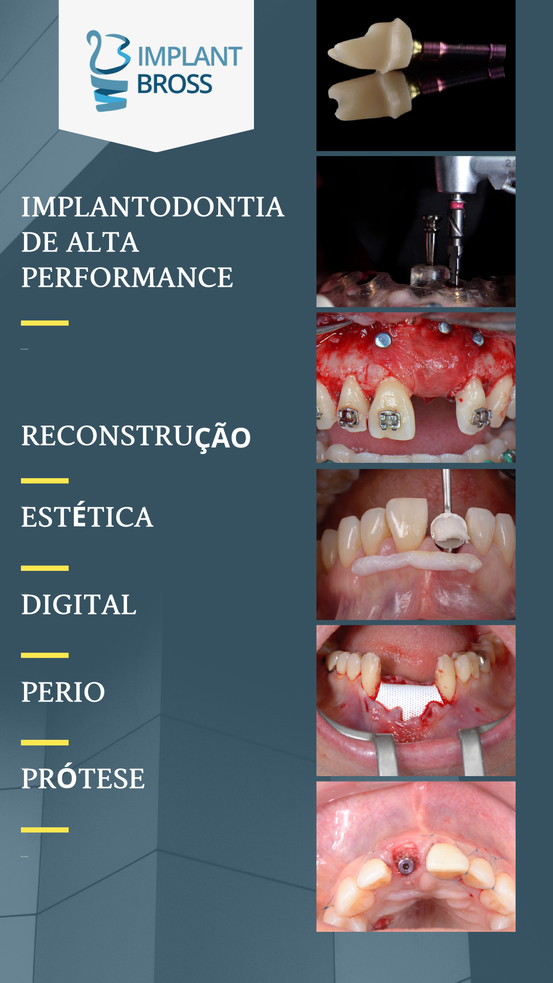 ESPECIALIZAÇÃO EM IMPLANTE.pdf (4).png