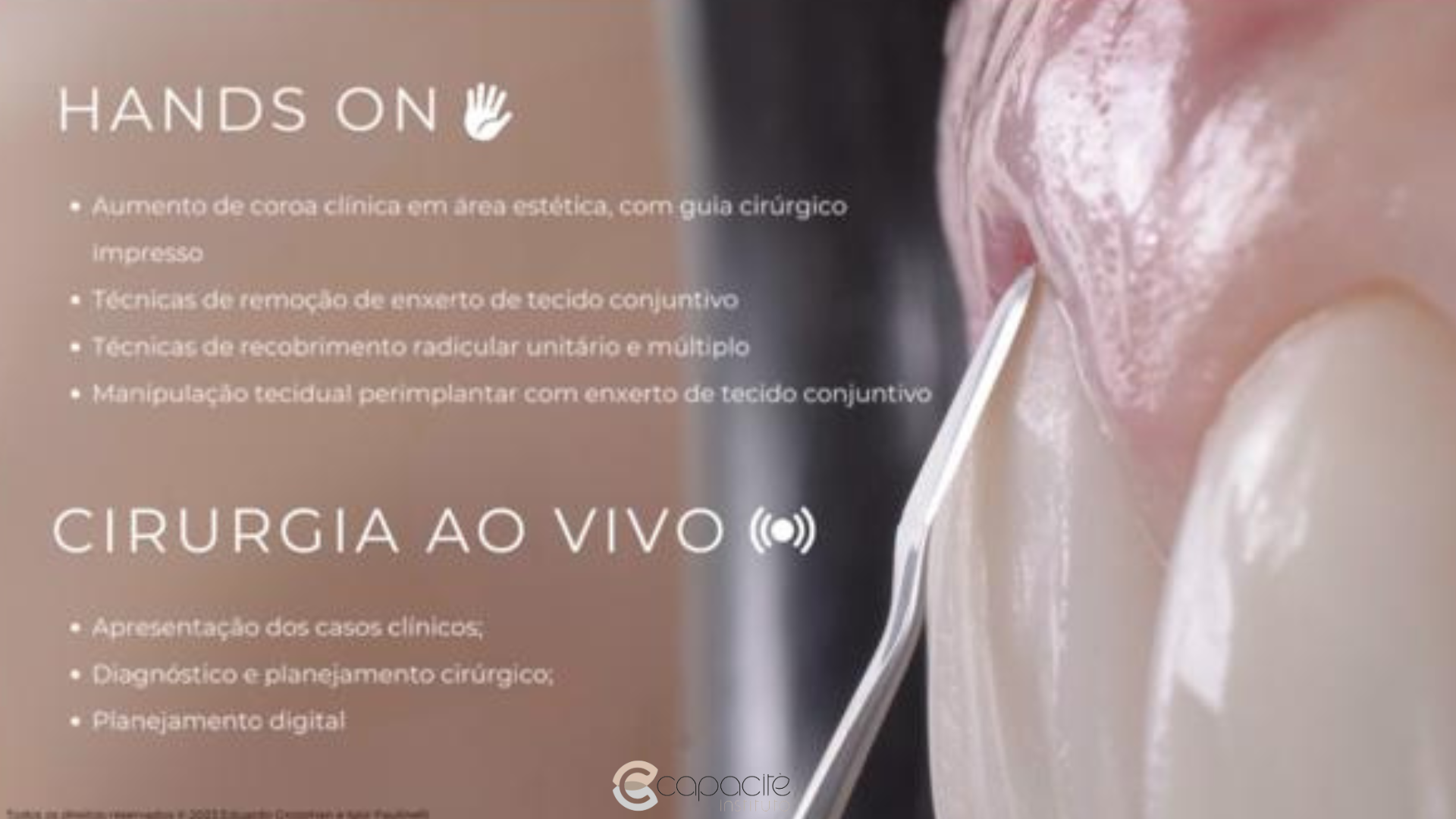 Imersão em Cirurgia Plástica Perimplantar (4).png