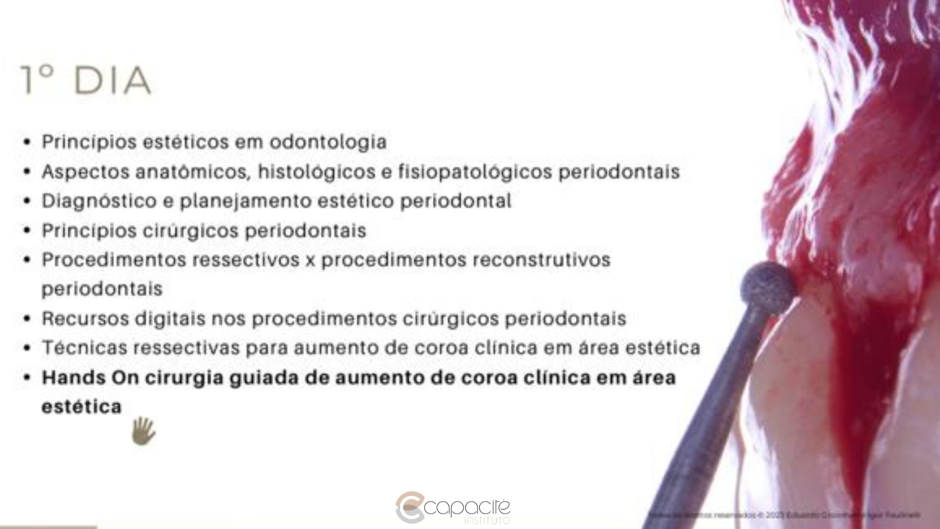 Imersão em Cirurgia Plástica Perimplantar (5).png