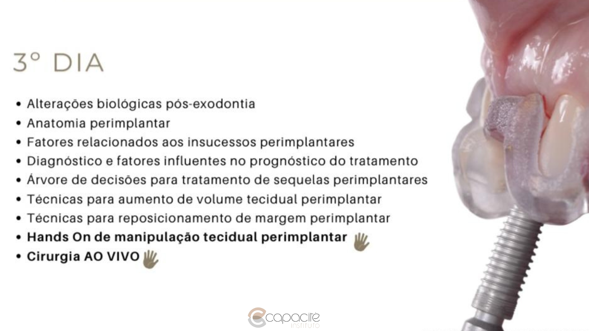 Imersão em Cirurgia Plástica Perimplantar (7).png